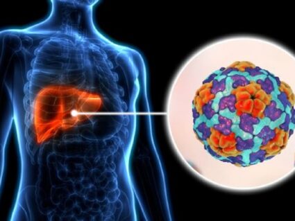 Surto de Hepatite A em Curitiba: Saúde confirma novo transplante em decorrência da doença