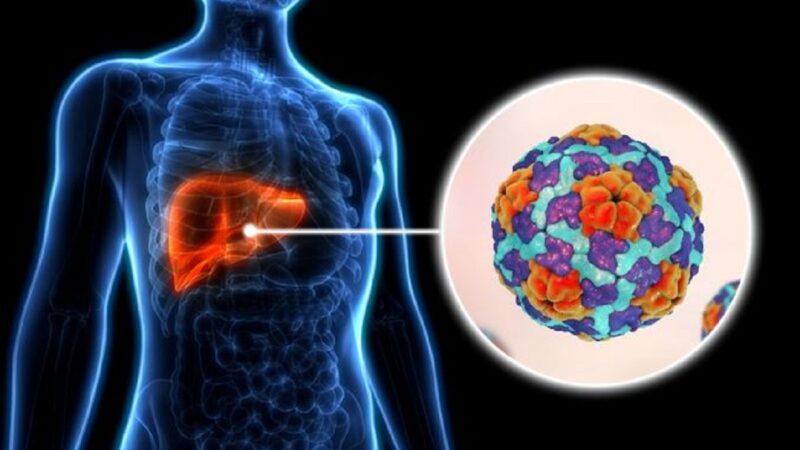 Surto de Hepatite A em Curitiba: Saúde confirma novo transplante em decorrência da doença